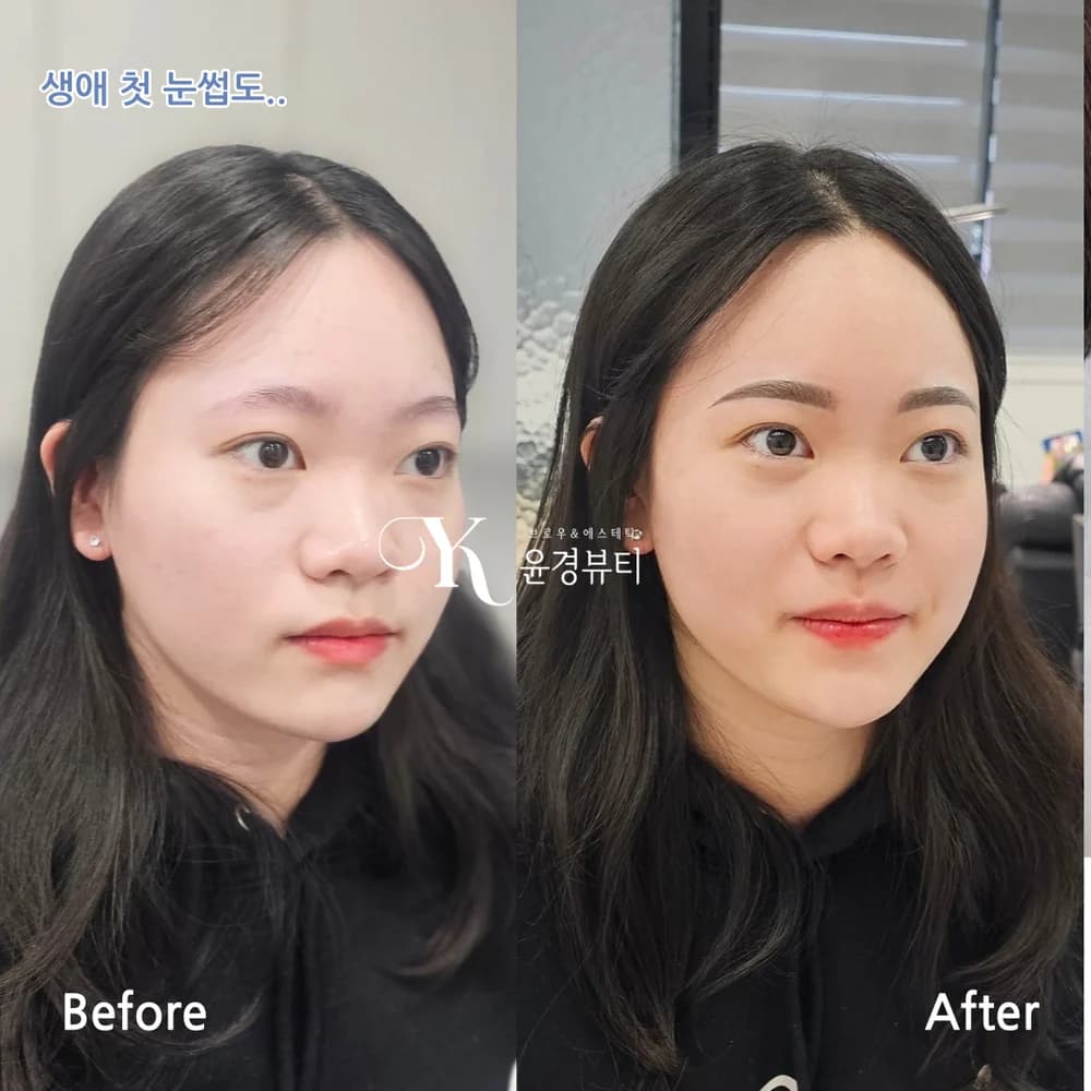 화장(옴브레) 눈썹 시술 사진