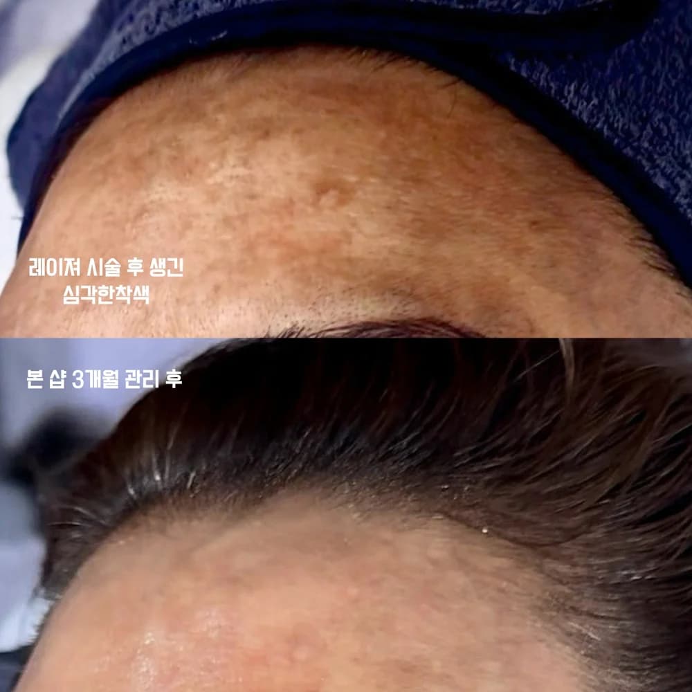 미백 · 리프팅 · 홍조관리 시술 사진