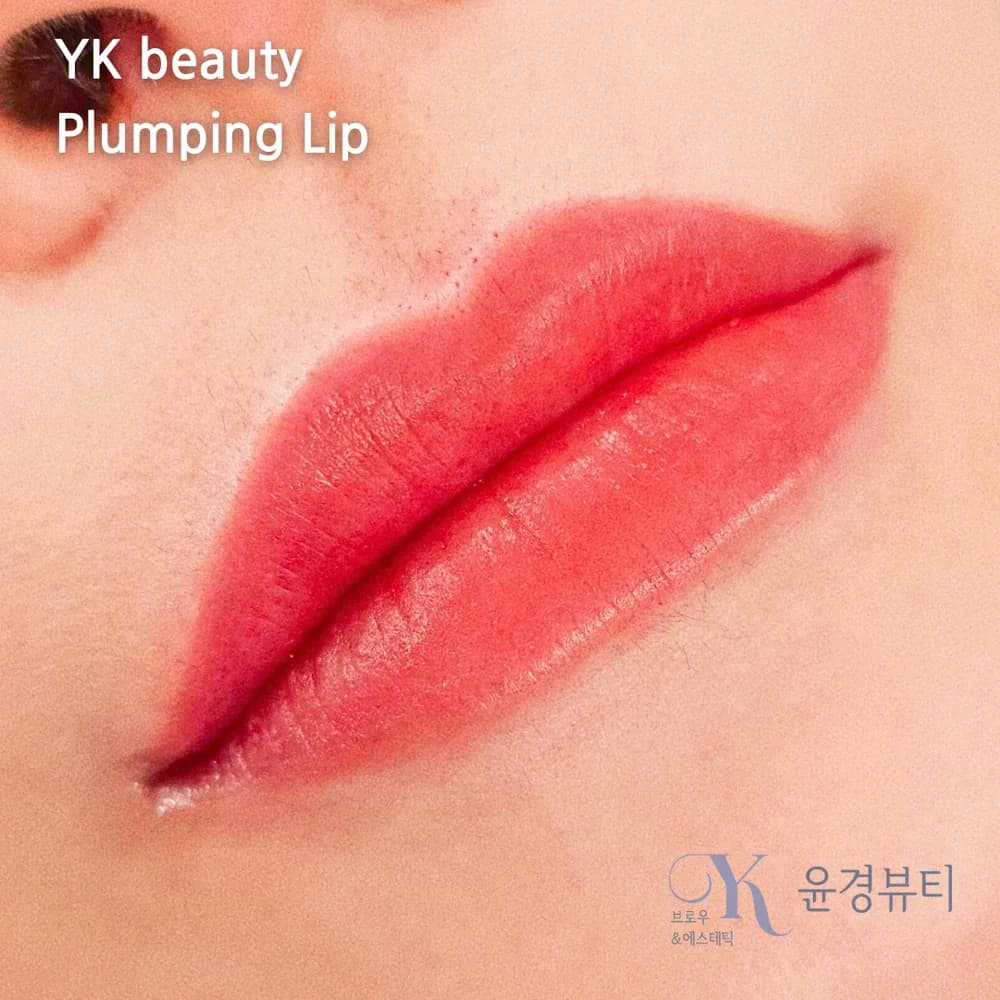 플럼핑틴트립 시술 사진