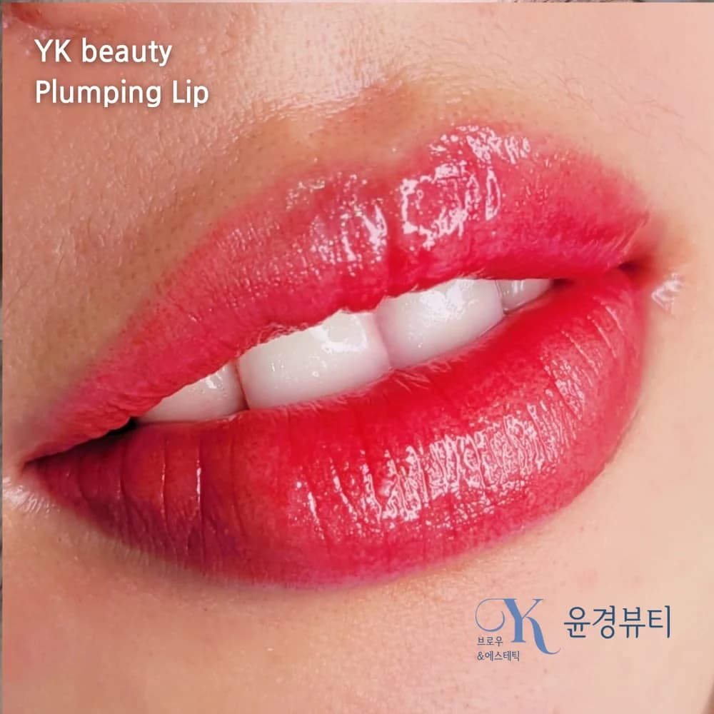 플럼핑틴트립 시술 사진